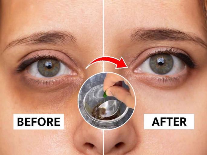 How to use coffee for dark circles? beauty secrets | डार्क सर्कल्समुळे चेहऱ्याचे सौंदर्य कमी झाले? कॉफीत मिसळून '१' गोष्ट लावा; डोळे दिसतील सुंदर