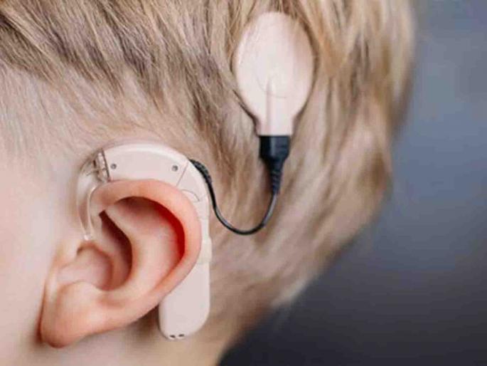 Sounds that little ones will hear again | ते चिमुकले पुन्हा ऐकू शकणार आवाज Sounds that little ones will hear again | ते चिमुकले पुन्हा ऐकू शकणार आवाज