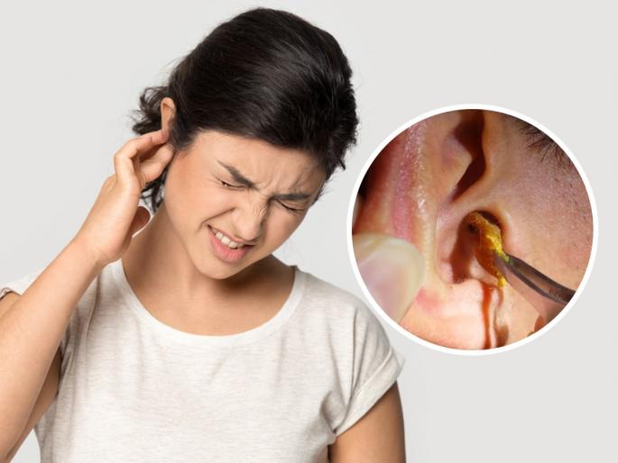 Got an ear full? Here's some advice for ear wax removal | कानात मळ झाला म्हणून कान कोरता? पाहा, कानात मळ झाला तर काय करायचे..