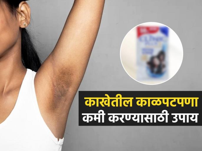 How to Get Rid Of Dark Underarms Apply 2 rupees shampoo in this way Tanning Will Remove | सततच्या घामामुळे अंडरआर्म्स काळेकुट्ट झाले; २ रुपयांचा शाम्पू ‘या’ पद्धतीनं लावा, स्वच्छ दिसतील
