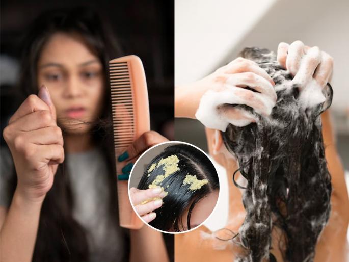 how to reduce hair fall after hair wash, best home remedies to control hair loss, Tips To Reduce Hair Fall While Shampooing | तुमचेही केस धुतल्यानंतर जरा जास्तच गळतात का? शाम्पूमध्ये ३ गोष्टी मिसळून लावा, केस गळणं थांबेल