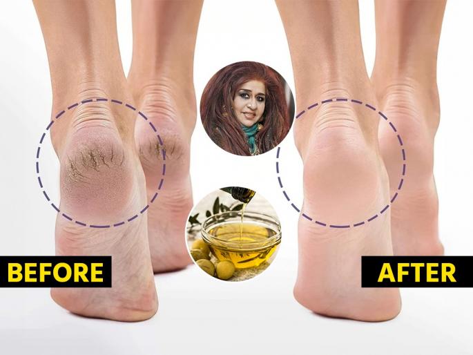 Winter Feet Care Tips To Make Them Beautiful By Beauty Expert Shahnaz Husain Follow Shahnaz Husain's Guide To Heal your heels during winters | भेगा पडल्यानं टाचा दुखतात? शहनाज़ हुसैन सांगतात एक जादुई तेल, टाचा दुखणं थांबेल