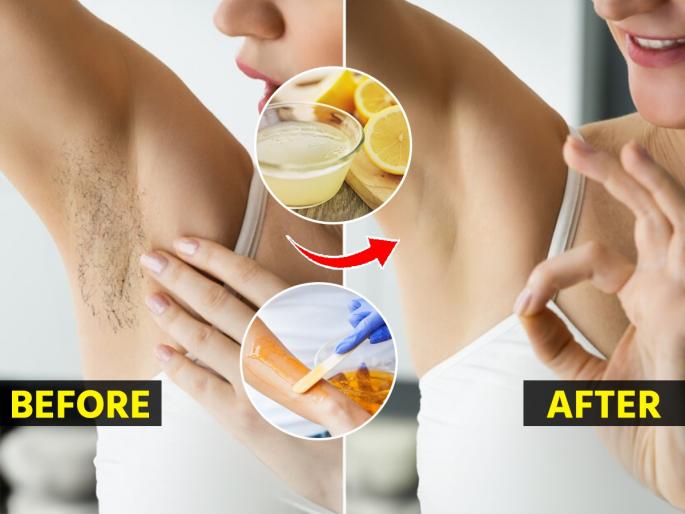 How to remove unwanted hair at home With Lemon How To Remove Unwanted Hair From Body With Lemon Home Remedies To Remove Body Hair Naturally | मध -साखर नको, फक्त वाटीभर लिंबाचा रस वापरुन घरच्याघरी वॅक्सिंग करण्याची नवी पद्धत...