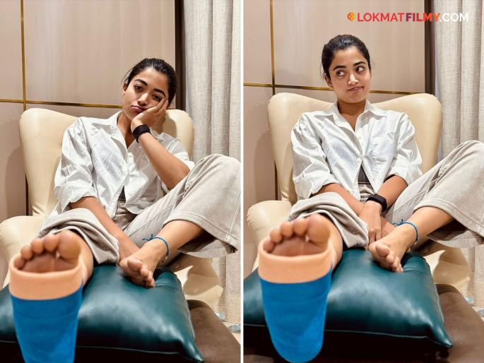 Rashmika Mandanna Suffers Leg Injury During Gym Workout Sikander Schedule Postponed | रश्मिका मंदानाला काय झालं? फोटो शेअर करत अभिनेत्री म्हणाली... Rashmika Mandanna Suffers Leg Injury During Gym Workout Sikander Schedule Postponed | रश्मिका मंदानाला काय झालं? फोटो शेअर करत अभिनेत्री म्हणाली...