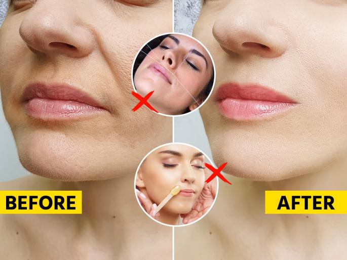 How To Remove Upper Lip Hair Naturally Without Pain How to keep upper lips clean without threading Waxing | थ्रेडींग-वॅक्सिंग नको, किचनमधील २ पदार्थ वापरुन करा वेदनारहित अप्पर लिप्स, पाहा खास उपाय...