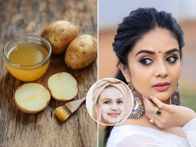 how to use potato for glowing skin, best home remedies to get rid of acne, pigmentation and tanning, use of potato juice for skin brightning | आठवड्यातून एकदा 'या' पद्धतीने चेहऱ्याला बटाट्याचा रस लावा- पिंपल्स, ॲक्ने, पिगमेंटेशन गायब..