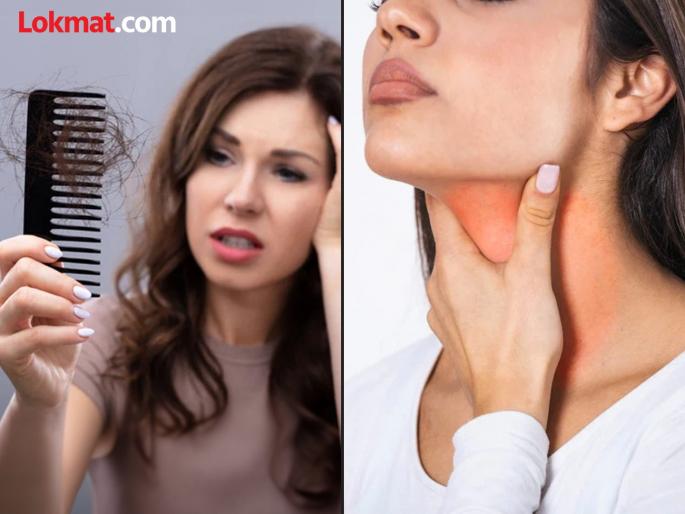 Weight gain or loss, hair loss, is it a thyroid disease? | वजन कमी-जास्त होते, केस गळतात, थायरॉईड तर नाही ना? Weight gain or loss, hair loss, is it a thyroid disease? | वजन कमी-जास्त होते, केस गळतात, थायरॉईड तर नाही ना?