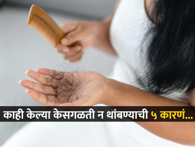 What are the top 5 reasons for hair loss Top 5 Reasons Why Hair Loss Happens hair fall causes top 5 reasons behind | कितीही शाम्पू लावा, तेल चोपडा केस गळतातच? ‘ही’ आहेत केस गळण्याची ५ खरीखुरी कारणं...