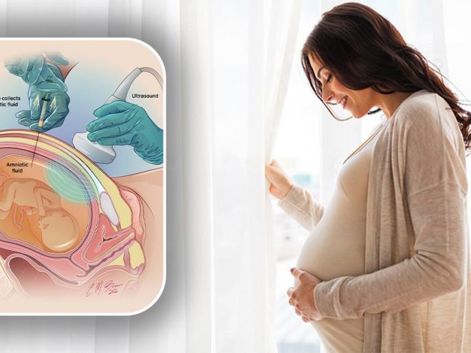 Is there any birth defect in the baby? Pregnant women should get this test done | बाळामध्ये जन्मतः काही दोष तर नाही ना? गर्भवतीने ही चाचणी करणे आवश्यक Is there any birth defect in the baby? Pregnant women should get this test done | बाळामध्ये जन्मतः काही दोष तर नाही ना? गर्भवतीने ही चाचणी करणे आवश्यक