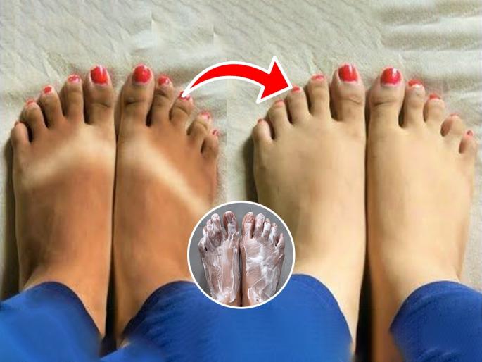 home remedies to remove tan from feet ankles dark in summer season skin care tips 5 simple hacks | पायाचे घोटे काळेकुट्ट झाले आहेत, भयानक दिसतात? ५ सोप्या टिप्स, काळवंडलेले पाय होतील स्वच्छ सुंदर