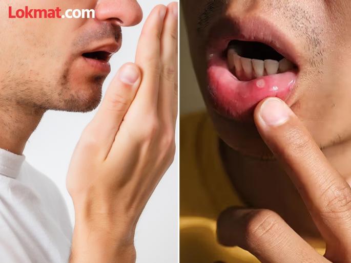 Does your mouth smell bad? This dental problem could be the main reason | तुमच्या तोंडातून दुर्गंधी येते का? दातांची ही समस्या असेल प्रमुख कारण Does your mouth smell bad? This dental problem could be the main reason | तुमच्या तोंडातून दुर्गंधी येते का? दातांची ही समस्या असेल प्रमुख कारण