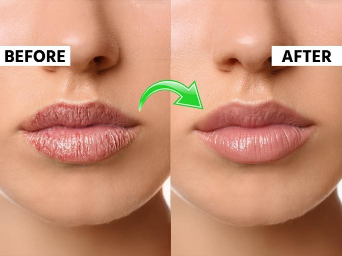 Do your lips crack and dry in summer do this Simple home remedies pink lips will become soft and smooth lips skin care tips | उन्हाळ्यात ओठ का फुटतात? साल निघतं, रक्त येतं अशा कोरड्या ओठांसाठी पाहा घरगुती उपाय