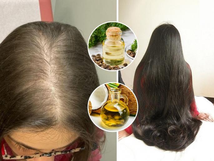 Which oils to use for different hair problems How To Choose The Right Hair Oil For Your Different Hair Problems Different Types of Hair Oils for Different Hair Problems | भरमसाठ कोंडा-केस गळणे यासह केसांच्या समस्यांसाठी ‘असे’ निवडा योग्य तेल, चुकीचे तेल-डोक्याला ताप...