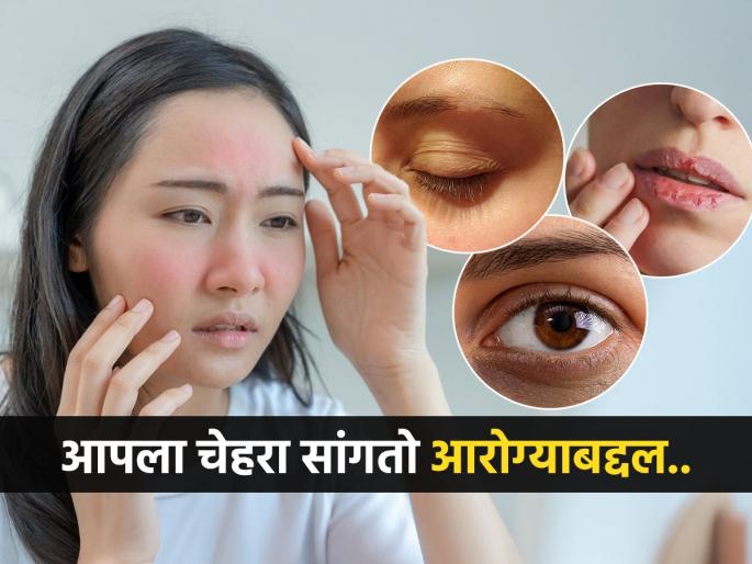 Face reveals health problems Dark circles- chapped lips- facial hair, symptoms of serious illness do not avoid doctor said | चेहरा सांगतो आरोग्याच्या तक्रारी! डार्क सर्कल- फुटलेले ओठ- चेहऱ्यावर केस येणे, गंभीर आजाराची लक्षणे