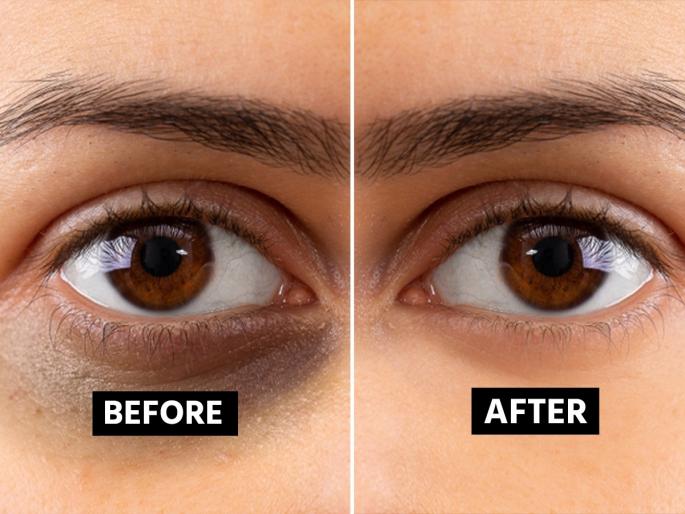 dark circle how to make under eye cream ayurvedic home remedies how to use nutmeg and mulethi powder skin care tips | डोळ्यांखाली काळी वर्तुळं? २ सोपे उपाय, निस्तेज डोळे होतील सुंदर- त्वचेचा ग्लो वाढतच जाईल...!
