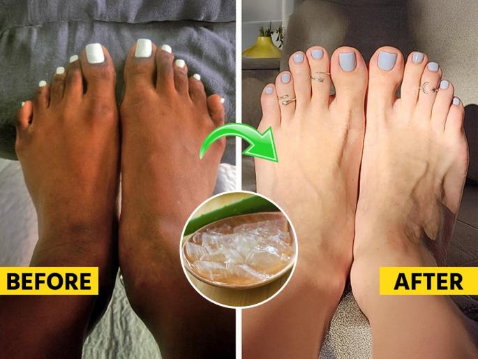 5 steps pedicure at home, how to do pedicure at home, home hacks for cracked heel,  | तळपाय कोरडे पडून खूपच भेगाळले? घरीच करा पेडिक्युअर- काळवंडलेले पाय दिसतील स्वच्छ, सुंदर