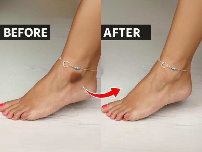 how to reduce blackness of ankle, how to get rid of tanned ankle, Tips to get rid of dark ankles | पायाचे घोटे काळवंडून खूपच घाण दिसू लागले? ३ उपाय- ५ मिनिटांत घोटे होतील स्वच्छ