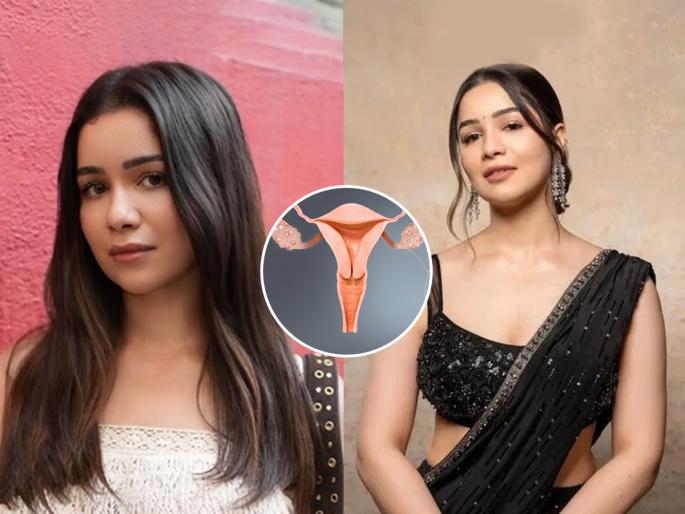 Sara Tendulkar Talks About Her Struggles With PCOS, sara tendulkar sufferes from Polycystic ovary syndrome | सारा तेंडुलकर म्हणते- PCOS मुळे घराबाहेर जाण्याचीही लाज वाटायची; कारण माझा चेहरा..... 