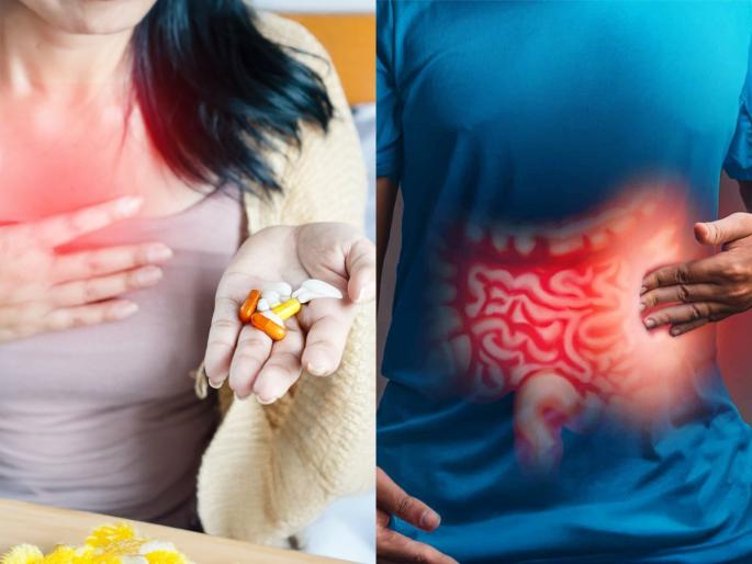 acidity problem, Chest pain, constipation issue taking medication for acidity Gut health is affected home remedies experts say | छातीत सारखी जळजळ, ॲसिडिटीवर औषधे घेताय? Gut Health वर होतोय परिणाम, सोपा उपाय- तज्ज्ञ म्हणतात..