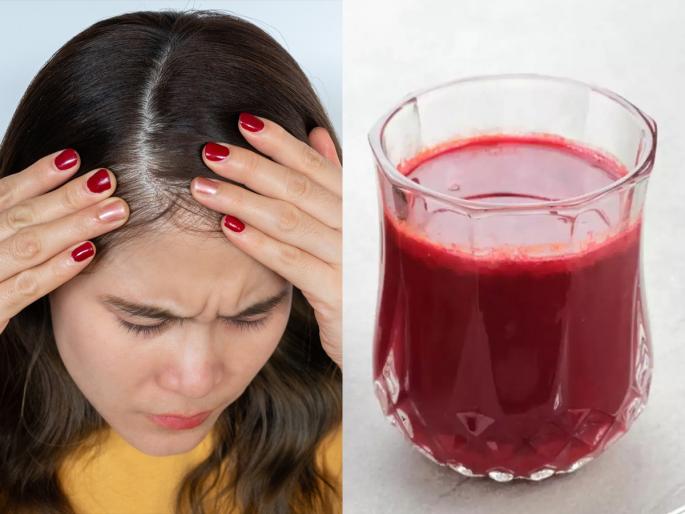 hair loss issue beetroot and amla ayurvedic drink boost for hair growth hair care tips | प्रमाणापेक्षा जास्त केसगळती-टक्कल पडण्याची भीती वाटते? रोज प्या आयुर्वेदिक ड्रिंक, केसांच्या वाढीसाठी असरदार उपाय