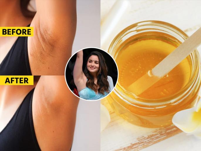 Tired of dark, pigmented underarms & stubborn hair Here’s a simple homemade wax that works like magic and it’s all natural Homemade Wax For Hair Removal & Darkness of Underarms at Home Made Easy | काखेतील काळेपणा व वॅक्सिंग, दोन्हींसाठी करा एकच खास उपाय, अंडरआर्म्स दिसतील सुंदर - स्वस्त आणि मस्त...