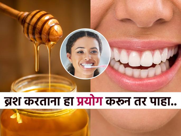 how to get rid of yellow teeth, how to reduce yellow colour on teeth, best home hacks for teeth whitening, use of honey for teeth | मधाने दात घासा आणि नंतर 'हा' उपाय करा! पिवळे पडलेले दात पांढरेशुभ्र होऊन चमकतील... 