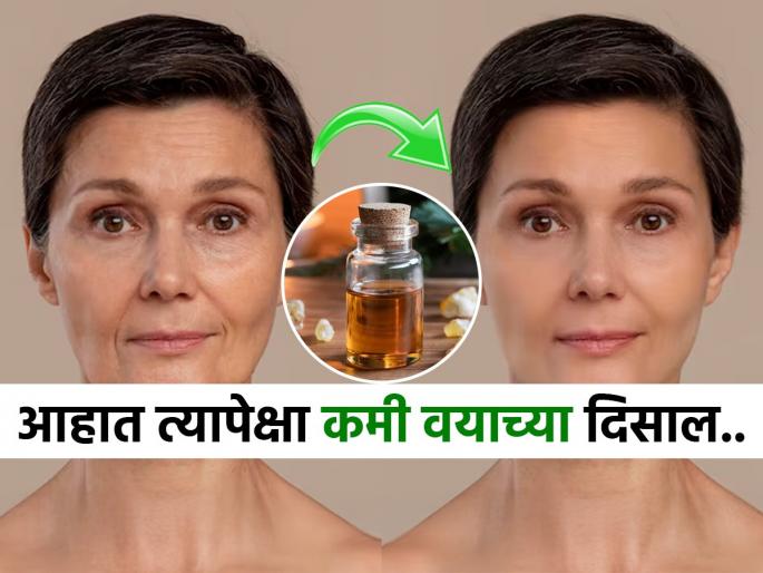 natural Botox treatment for reducing wrinkles, how to get rid of fine lines, how to keep skin young looking and tight  | डोळ्यांभोवती-कपाळावर बारीक सुरकुत्या दिसू लागल्या? लगेचच 'हे' तेल लावा- सुरकुत्या गायब