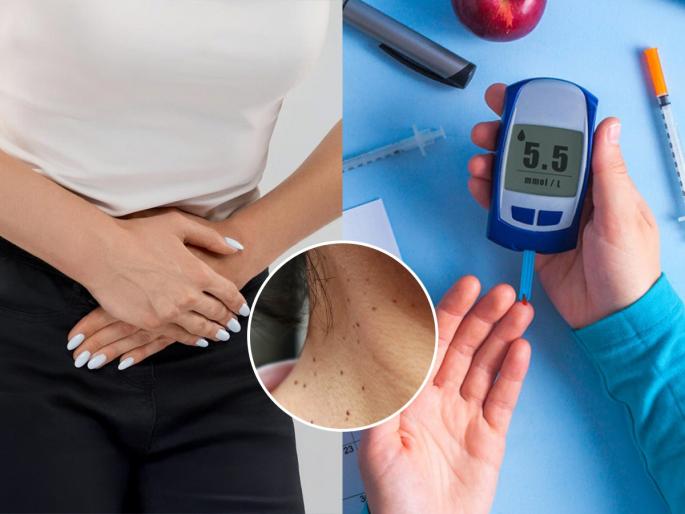 2 major symptoms of diabetes that seems in pre diabetic stage, type 2 diabetes symptoms in men and women before diagnosis | डायबिटीस होण्याआधी महिलांच्या शरीरात दिसू लागतात २ लक्षणं! शुगर कायमची मागे लागण्यापूर्वी दिसतो धोका