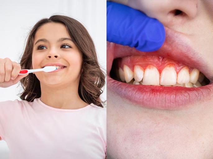 teeth cavity issue bleeding gums while brushing teeth causes and preventaion simple teehth cleaning tips | ब्रश करताना हिरड्यांमधून रक्त येते? डॉक्टरांनी सांगितला सोपा उपाय, दातांच्या समस्या होतील कमी