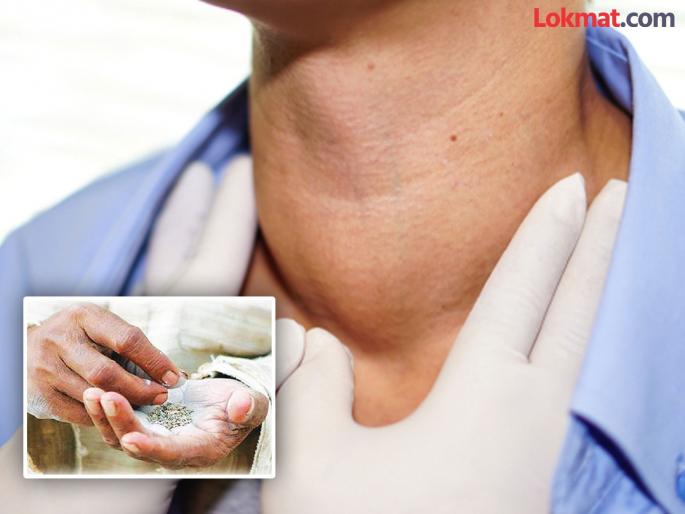 44% of cancer patients in rural areas are tobacco users: Shocking findings | ग्रामीण भागात ४४% कॅन्सर रुग्ण तंबाखू सेवन करणारे : धक्कादायक निष्कर्ष 44% of cancer patients in rural areas are tobacco users: Shocking findings | ग्रामीण भागात ४४% कॅन्सर रुग्ण तंबाखू सेवन करणारे : धक्कादायक निष्कर्ष