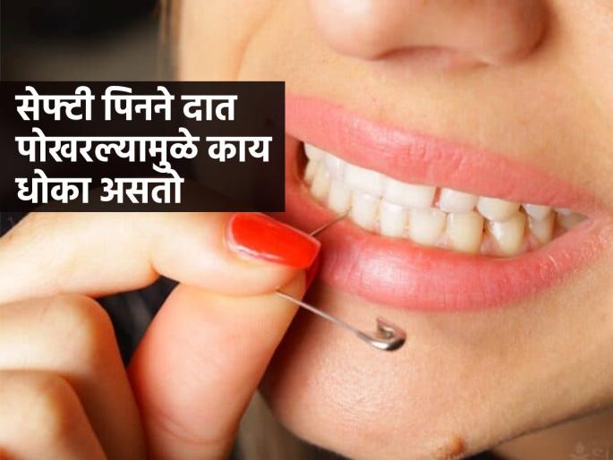 Do you pick your teeth with sharp objects? You should never make this mistake | टोकदार वस्तूंनी दात पोखरता? ही चूक अजिबातच करायची नाही, होत्याचे नव्हते होईल, चावणेही मुश्कील!!!