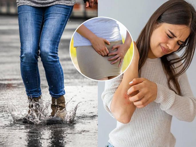 Does damp clothes cause itchy skin and rashes during monsoon? Try these 5 home remedies immediately | पावसाळ्यात ओलसर कपड्यांमुळे त्वचेला खाज सुटते, रॅश येते? करा '५' घरगुती उपाय तातडीने
