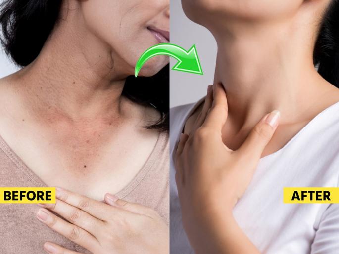 Dark patches on the neck? See the causes of dark neck and 4 home remedies | मानेजवळ काळेकुट्ट थर? पाहा मान काळी होण्याची कारणं आणि ४ घरगुती उपाय