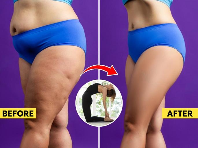 do you have Wrinkles on the thighs? The skin is stretched? Know the causes and solutions | मांड्यांवर सुरकुत्या दिसतात? त्वचा ओढली जाते? कारणे आणि उपाय जाणून घ्या