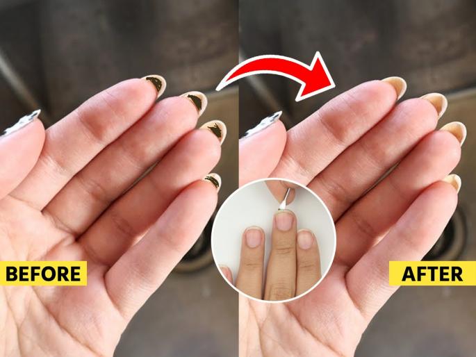 Dirt stuck in your nails won't come off? Simple home remedies | नखांत अडकलेली माती-घाण निघतच नाही? सोपे घरगुती उपाय-नखे राहतात स्वच्छ आणि आजारपण लांब