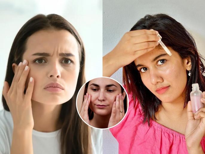 which serum is best for your skin how to know different skin problem pimples and pigmentation issue solve skin care tips | तुमच्या चेहऱ्यासाठी कोणतं फेस सिरम योग्य, ‘असं’ निवडा- पिंपल्सचे खड्डे-डाग होतील गायब