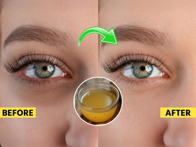 best home hacks for reducing dark circles, reasons and causes of dark circles, how to get rid of dark circles  | डार्क सर्कल्समुळे डोळे खोल गेलेले दिसतात? घ्या एका रात्रीत डार्क सर्कल्स कमी करणारा उपाय