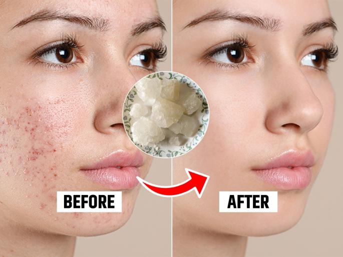 use alum in these 4 ways in morning routine to get soft and glowing skin how to use fitkari on face for brightening skin 4 Ways To Use The Alum Stone For Glowing Skin | तुरटीचा इवलासा खडा त्वचेवर करेल जादू! तुरटीच्या फेसपॅकपासून टोनरपर्यंत त्वचेसाठी 'असा' करा वापर...