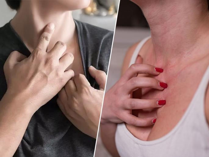 Does itchy chest troubles you? Wearing the wrong bra can be dangerous, a sign of a serious illness see what you need to know | छातीजवळ सारखी खाज सुटते? चुकीची ब्रेसियर वापरणं ठरतंय धोकादायक, मोठ्या आजाराची लक्षणं..