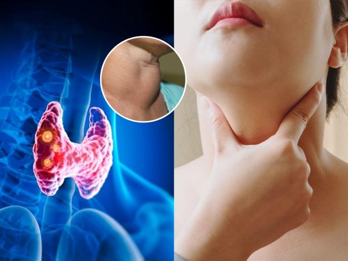 Thyroid is a problem for most women, see how to get tested and how to take care of yourself | बहुसंख्य महिलांना छळतोय थायरॉईड, पाहा कशी करायची तपासणी आणि प्रत्यकीने कशी घ्यायची काळजी..