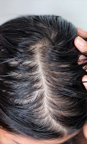 haircare tips, Even if you don't apply oil, your hair looks greasy and your face also gets oily? Do 10 simple things | तेल लावलं नाही तरी केस चिप्प तेलकट दिसतात, चेहराही ऑइली होतो? करा १० सोप्या गोष्टी