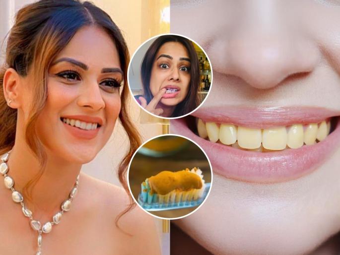 TV Actress Nia Sharma Share effective Home Remedy For Teeth Whitening And Remove Plaque | दातांवर पिवळा थर दिसतो, पांढऱ्याशुभ्र दातांसाठी अभिनेत्री निया शर्मा सांगतेय १ देशी उपाय