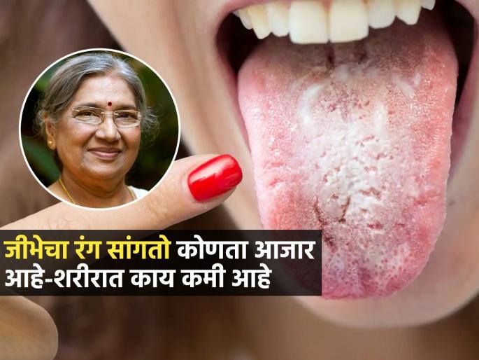 What Does The Color Of Your Tongue Indicate Can Tongue color Indicate Vitamin Deficiency | ब्रश करताना जीभकडे लक्ष द्या-शरीरात काय कमी आहे आपोआप कळेल; हंसाजी योगेद्र सांगतात.....