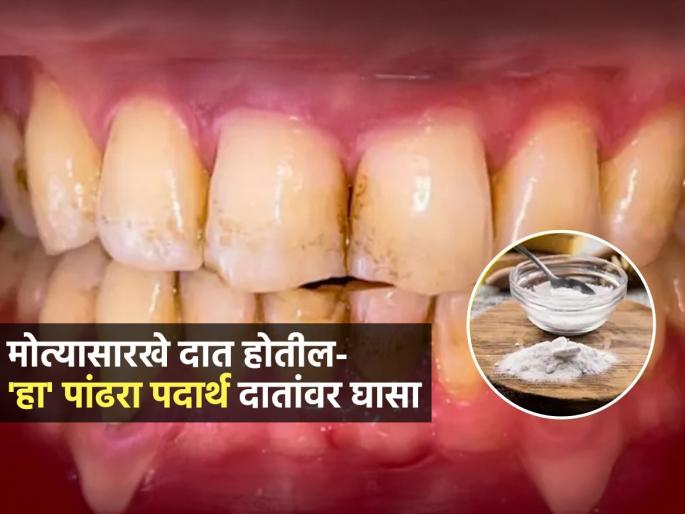 What Is best Solution For Whiten Your Teeth Ayurvedic doctor Shares Home Remedies | दात कायम पिवळे दिसतात? झोपण्याआधी चिमूटभर हा पदार्थ दातांवर घासा; सकाळी चमकतील दात