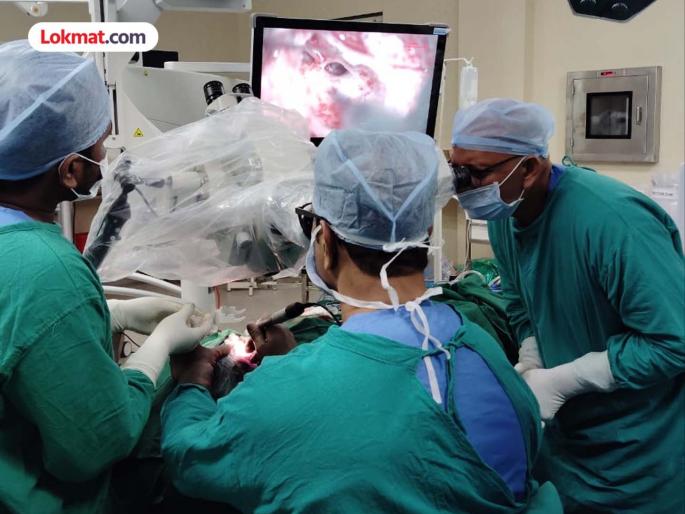 The baby will be able to hear after four and a half years. The first cochlear implant surgery in the state's public health department is successful. | साडेचार वर्षानंतर बाळाला ऐकू येणार.. राज्याच्या सार्वजनिक आरोग्य विभागातील पहिली क्वॉक्लियर इम्प्लांट शस्त्रक्रिया यशस्वी