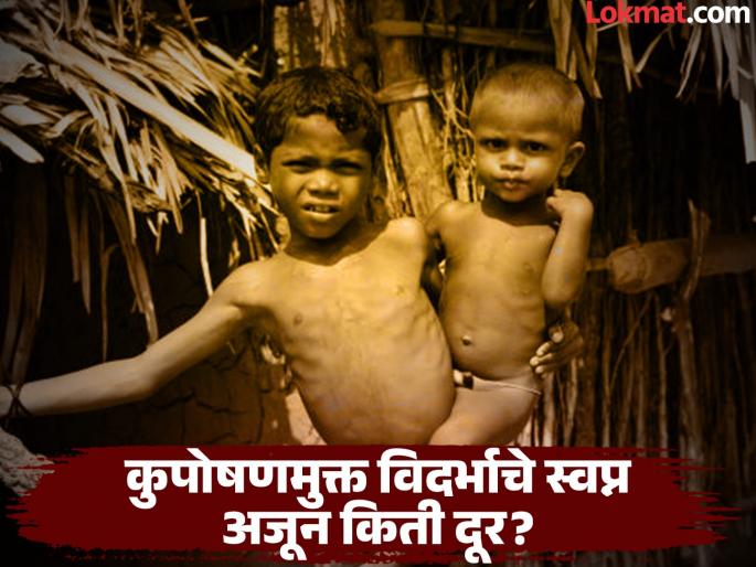 The picture of malnutrition in East Vidarbha is frightening! 638 severely, 3653 moderately malnourished children in Bhandara | पूर्व विदर्भातील कुपोषणाचे चित्र भयावह ! भंडाऱ्यात ६३८ तीव्र, ३६५३ मध्यम कुपोषित बालके