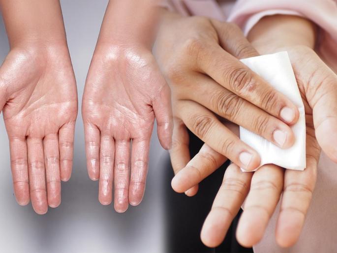 Do your palms sweat? Is this normal or a sign of a serious illness? Learn simple home remedies | हाताच्या तळव्यांना घाम येतो? हे नॉर्मलच की गंभीर आजाराचे लक्षण? जाणून घ्या सोपे घरगुती उपाय