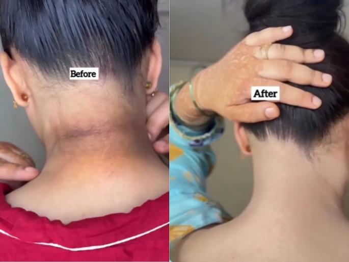 Tips And Tricks To Remove Neck Tanning : Use One Tomato to Reduce Neck tanning | चेहऱ्यापेक्षा मान काळपट दिसते? अर्ध्या टोमॅटोचा 'हा' उपाय करा, काळे थर जातील-त्वचा उजळेल