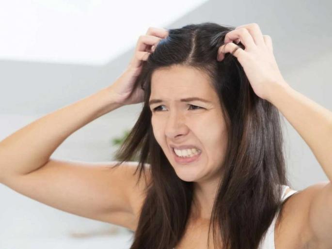 Itchy scalp? never ignore it, it can cause serious problems, see what to do | डोक्यात सारखी खाज सुटते? कोंडा समजून दुर्लक्ष केल्यास होतात गंभीर त्रास, डोकं जाईल कामातून.. Itchy scalp? never ignore it, it can cause serious problems, see what to do | डोक्यात सारखी खाज सुटते? कोंडा समजून दुर्लक्ष केल्यास होतात गंभीर त्रास, डोकं जाईल कामातून..