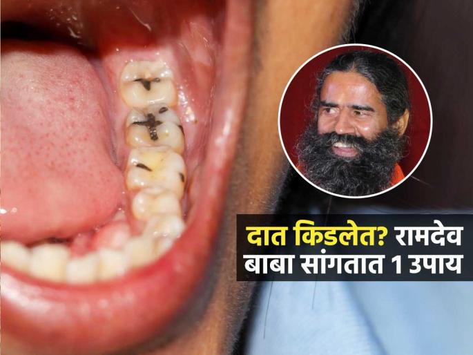 Baba Ramdev Told Desi Hacks To Remove Tooth Decay How To Remove Kida From Teeth | दात किडायला लागले, तोंडालाही दुर्गंधी येते? रामदेव बाबा सांगतात १ उपाय; दात राहतात मजबूत Baba Ramdev Told Desi Hacks To Remove Tooth Decay How To Remove Kida From Teeth | दात किडायला लागले, तोंडालाही दुर्गंधी येते? रामदेव बाबा सांगतात १ उपाय; दात राहतात मजबूत